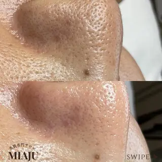 美肌専門サロン MIAJUのエステ・リラクイメージ