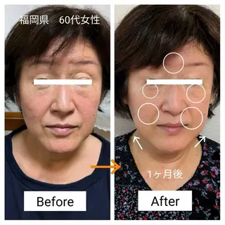 天使のしずく 神戸店所属・幹細胞エクソソーム 専門店 天使のしずくのその他イメージ