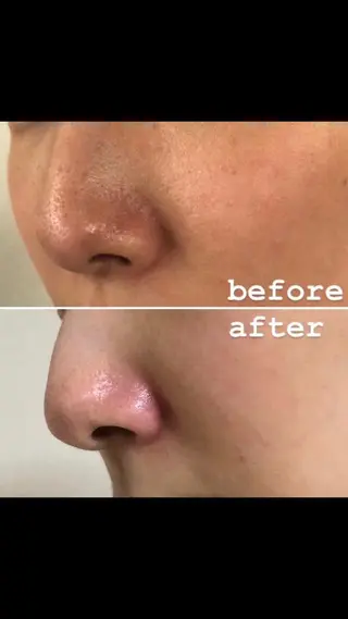 メンズ 朝重い人専用 肩甲骨調整のエステ・リラクイメージ