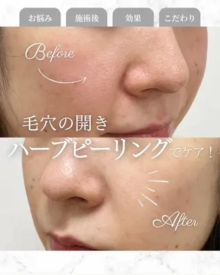 Astorie 相模大野エステのその他イメージ