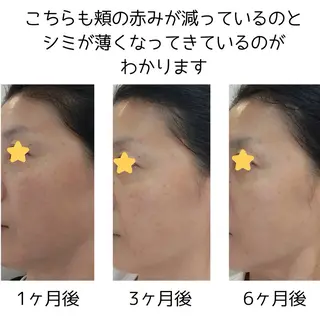 POLA The Beauty印場店のエステ・リラクイメージ