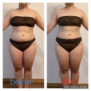 エステティックサロンアトリエホミィ所属・エステティックサロン アトリエ　ホミィのエステ・リラクイメージ