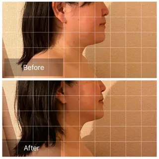 表情筋フェイシャル 三軒茶屋のエステ・リラクイメージ