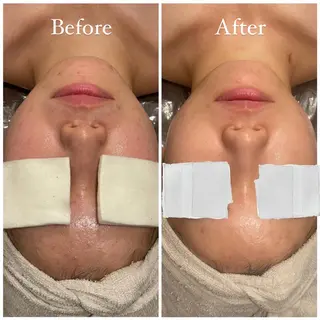 Tulipe Chihoのエステ・リラクイメージ