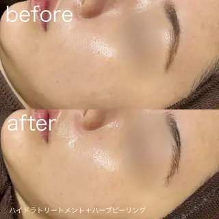 lulularico Yuのエステ・リラクイメージ