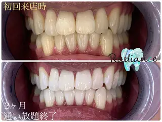 札幌ホワイトニング ラディアンス札幌駅店のその他イメージ