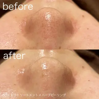 lulularico Yuのエステ・リラクイメージ