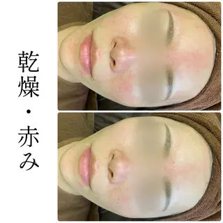 ハーブピーリング専門 BIOEL横浜のエステ・リラクイメージ