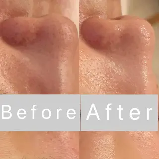 小顔&毛穴・肌質改善 LINDA西宮 AIのその他イメージ