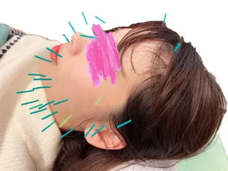 MOXA鍼灸院所属・MOXA鍼灸院 旧:鍼灸整体院Ranのエステ・リラクイメージ