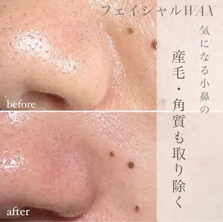 エピナス町田店 ブラジリアンワックスのエステ・リラクイメージ