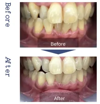 enu beauty salonのマツエク・マツパデザイン