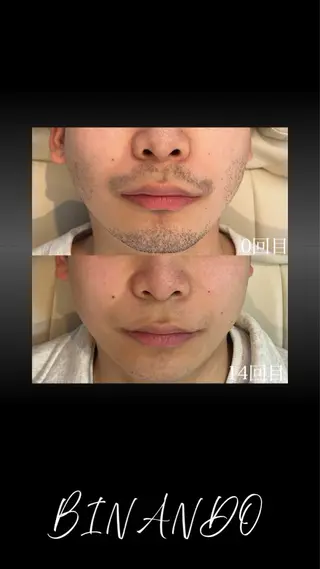 メンズ BINANDO 桑原の眉毛・アイブロウイメージ