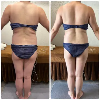 FLEUR 2号店のエステ・リラクイメージ