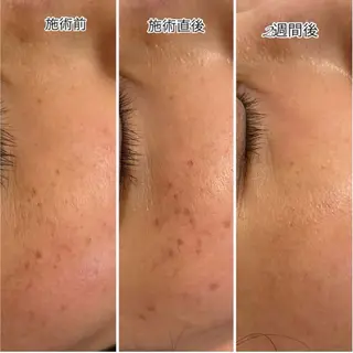 シミケア専門店 HAQUAのエステ・リラクイメージ