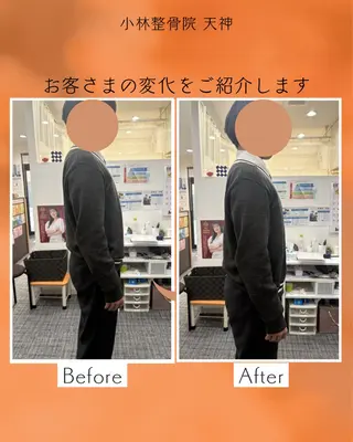 小林整骨院 天神所属・宮﨑 辰徳のエステ・リラクイメージ