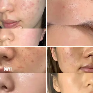 愛維美水光美肌専門店所属・愛維美水光美肌専門店 メンズレディースokのエステ・リラクイメージ