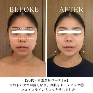 【目黒】本格痩身✴︎ 最新型よもぎ蒸しのエステ・リラクイメージ