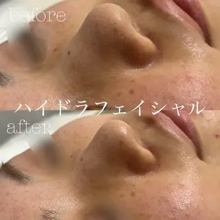 フェイシャルサロン CHIARA 荒田のエステ・リラクイメージ