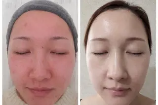 上尾Luce. あきやまのエステ・リラクイメージ