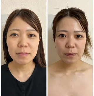 肌管理 OGUMOのエステ・リラクイメージ