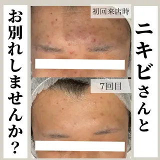 小林 玲菜のエステ・リラクイメージ