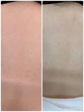 salon merci和泉のエステ・リラクイメージ