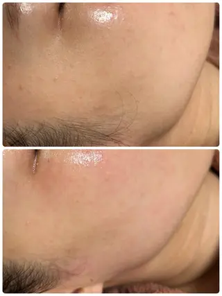 beauty  salon sorelle所属・産毛角質ケア/艶肌 フェイシャルワックスのエステ・リラクイメージ