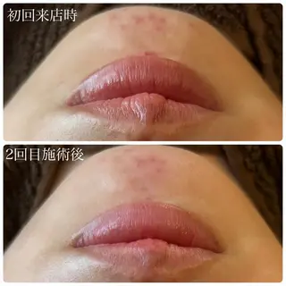 肌管理サロン Briller所属・肌管理サロン Briller 押上のエステ・リラクイメージ