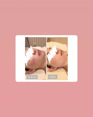 ULULU 上野店のエステ・リラクイメージ