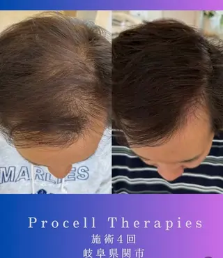 氣楽所属・松下 さゆりのエステ・リラクイメージ