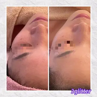 3glitter 肌質改善＆痩身のエステ・リラクイメージ