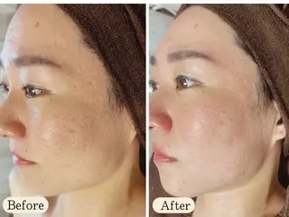 UI LANIのエステ・リラクイメージ