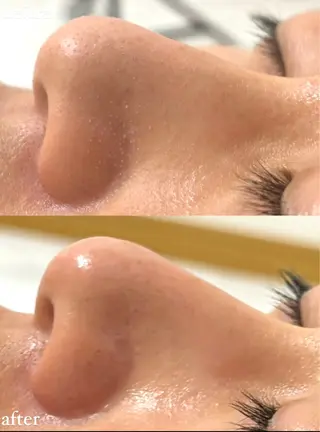 女性専門お顔剃り sunraineのエステ・リラクイメージ