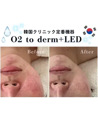 韓国肌管理🇰🇷 水光肌/肌質改善🫧のエステ・リラクイメージ