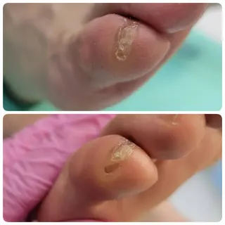 東京巻き爪 アカデミーのエステ・リラクイメージ