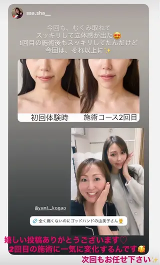 la lumie're (ラ リュミエール)所属・小顔サロン (ラ リュミエール)のエステ・リラクイメージ