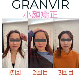 GRANVIR グランヴィールのエステ・リラクイメージ
