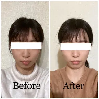 小顔矯正サロン AYURのエステ・リラクイメージ