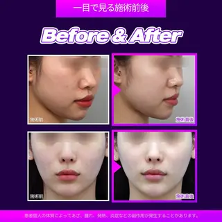 ハーブピーリング専門 毛穴洗浄❤️眉waxのエステ・リラクイメージ