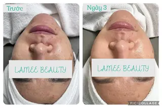 LAMEE BEAUTY所属・LAMEE BEAUTYのエステ・リラクイメージ