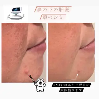Lumiere despoirのエステ・リラクイメージ