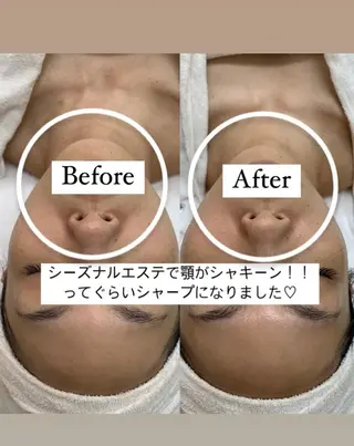 山口 萌のエステ・リラクイメージ