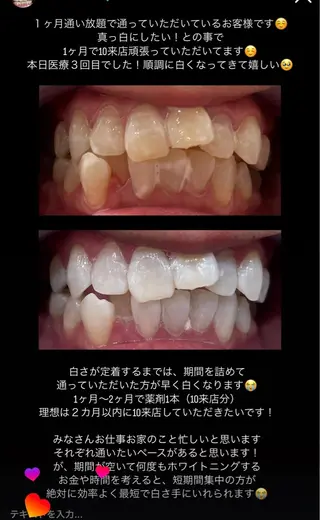 Kaula ホワイトニング🦷✨のエステ・リラクイメージ