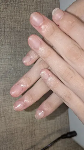 ネイル フィルイン・深爪矯正 長さ出し🎀のネイルデザイン