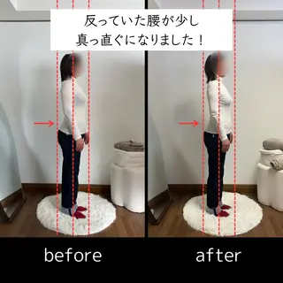 肩こり・巻き肩・姿勢 ｜深層筋｜大阪西区のエステ・リラクイメージ