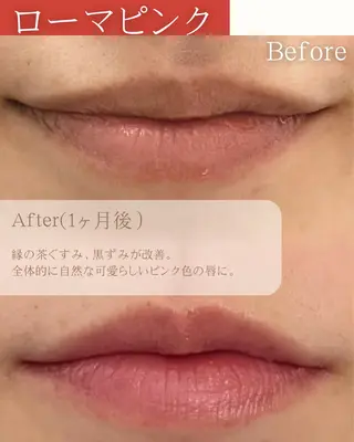 【ローマピンク施術】 Kaoのその他イメージ