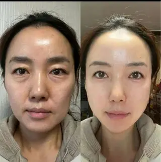 マツエク・マツパ aliaハーブ水光店 エステティシャン募集のエステ・リラクイメージ