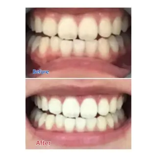 M渋谷 ホワイトニングのエステ・リラクイメージ