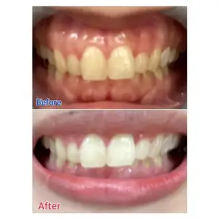 M渋谷店所属・M渋谷 ホワイトニングのエステ・リラクイメージ